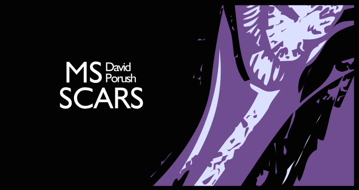 MS Scars